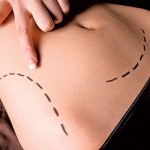 Tummy tuck and medicine as a for-profit business