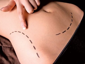 Tummy tuck and medicine as a for-profit business